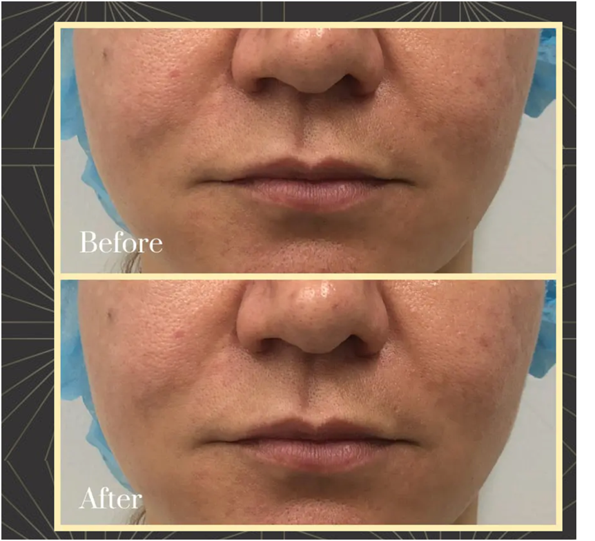 Different Treatments For A Younger Appearance